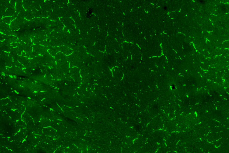 Researchers identify brain region involved in oxycodone relapse