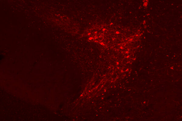Researchers pinpoint brain cells that delay first bite of food