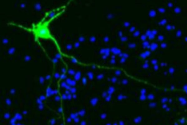 How air pollution and wildfire smoke may contribute to memory loss in Alzheimer’s disease