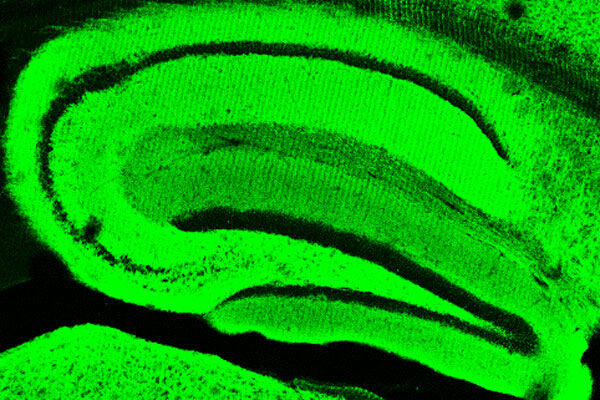 Compound found in common herbs inspires potential anti-inflammatory drug for Alzheimer’s disease