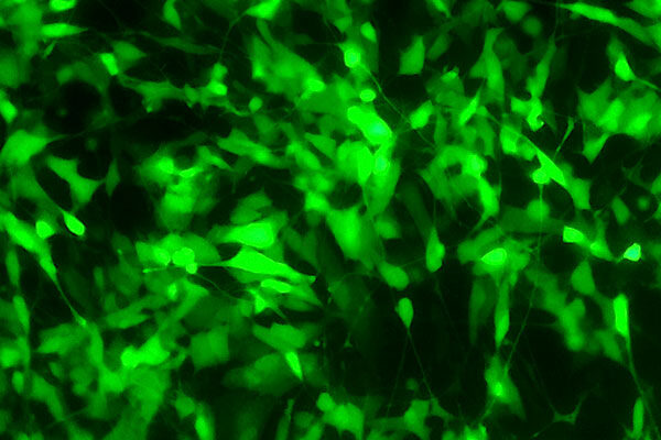 Enzyme engineering opens door to novel therapies for Parkinson’s, cancers and other hard-to-target protein diseases