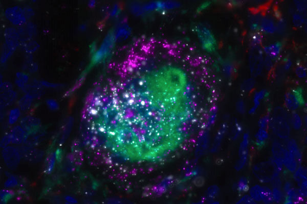 A gentle approach offers new hope for inflammatory lung diseases