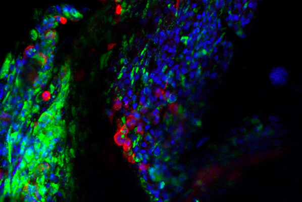 Researchers map key human proteins that power coronavirus replication, pointing to new treatment strategies