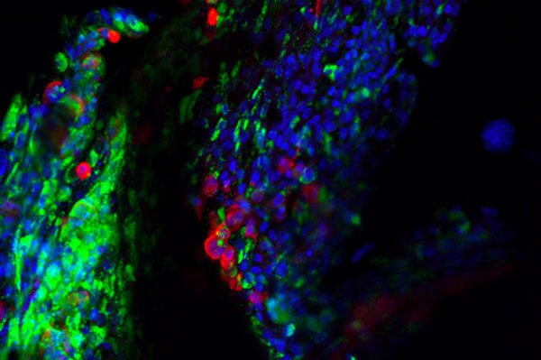 Researchers map key human proteins that power coronavirus replication, pointing to new treatment strategies