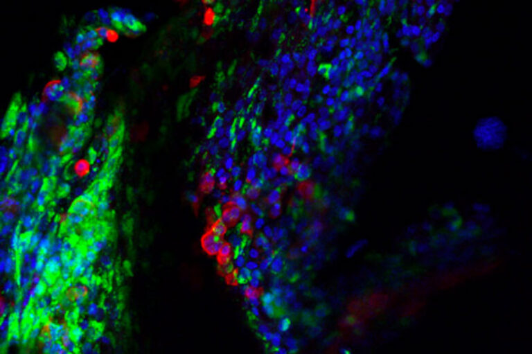 Researchers map key human proteins that power coronavirus replication, pointing to new treatment strategies