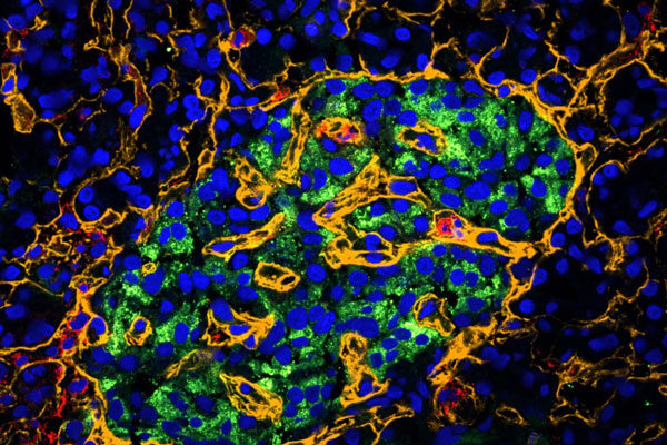 Scripps Research discovery could improve type 1 diabetes prevention and treatment