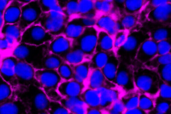 Scripps Research team identifies sugar molecules that trigger placental formation