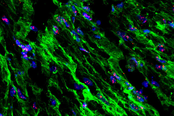 Scripps Research study reveals how uterine contractions are regulated by stretch and pressure during childbirth
