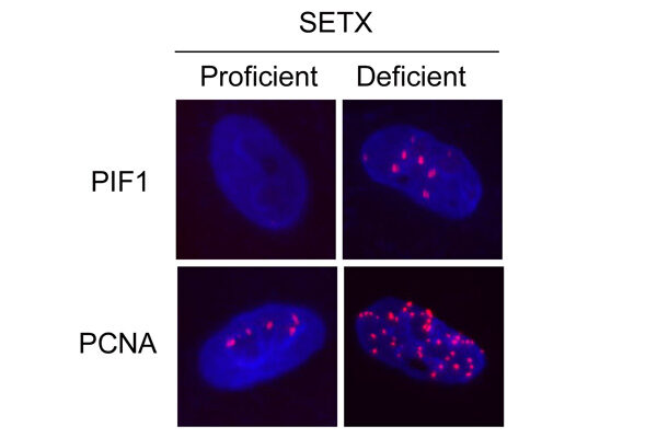 Scientists find cancer weak spot in backup DNA repair system