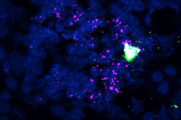 Study reveals a key hormonal circuit in the kidneys