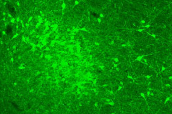 Study uncovers disrupted brain balance in alcohol dependence