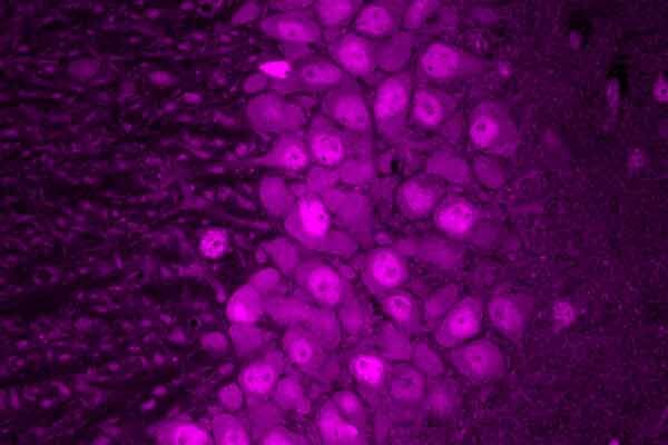 Mapping protein production in brain cells yields new insights for brain disease