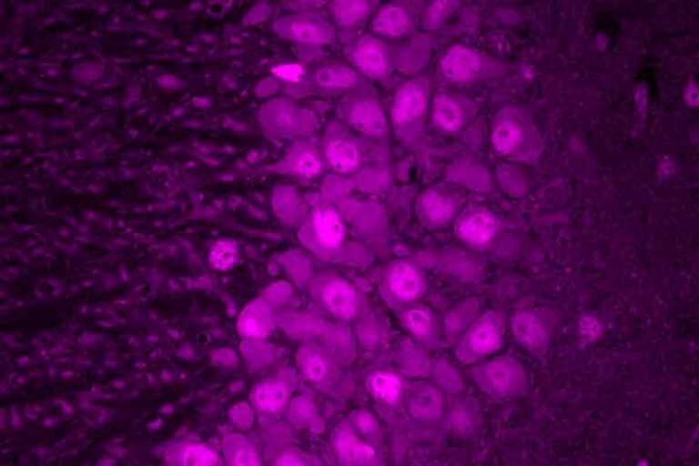 Mapping protein production in brain cells yields new insights for brain disease