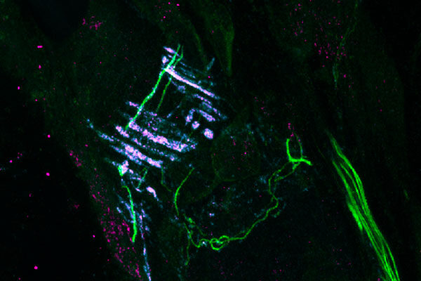 A new clue to how the body detects physical force