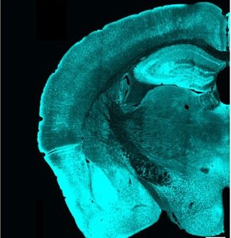 Levels of phosphorylated PDH (green) drastically increased in mouse brains cells after the mice were anesthetized for two hours