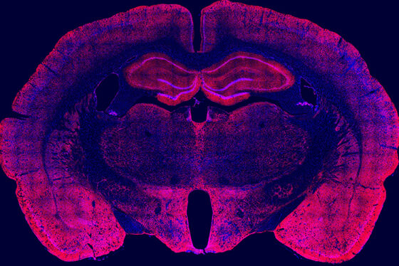 Fluorescence microscopy image of a coronal mouse brain section with red and purple labeling showing neuroanatomical regions relevant to addiction research.