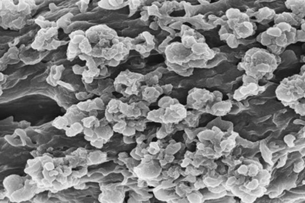 One Cytokine To Control Multiple Cytokines