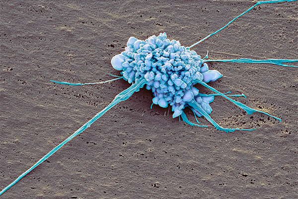 Outside-In Reprogramming: Antibody Study Suggests a Better Way to Make Stem Cells