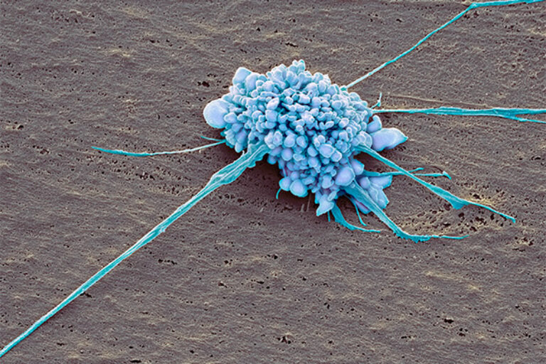 Outside-In Reprogramming: Antibody Study Suggests a Better Way to Make Stem Cells