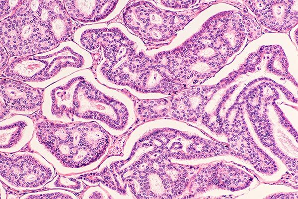 A New Approach to Cancer Drug Discovery