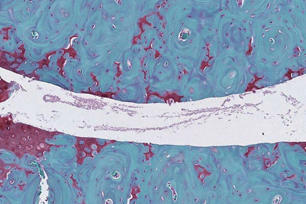 Scientists find key proteins control risk of osteoarthritis during aging