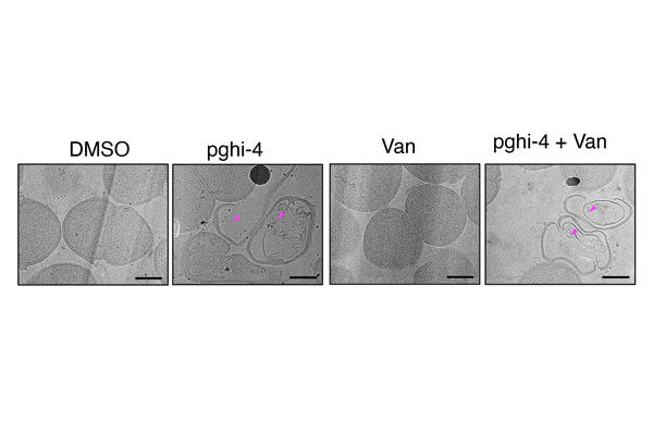 Back in action: Researchers make drug-resistant bacteria vulnerable again