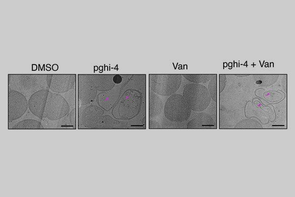 New research offers fresh insights for how to make better vaccines