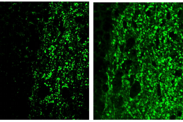 How a chemical reaction triggers brain inflammation in Alzheimer’s disease