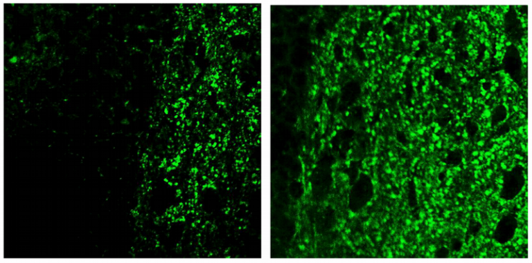 How a chemical reaction triggers brain inflammation in Alzheimer’s disease