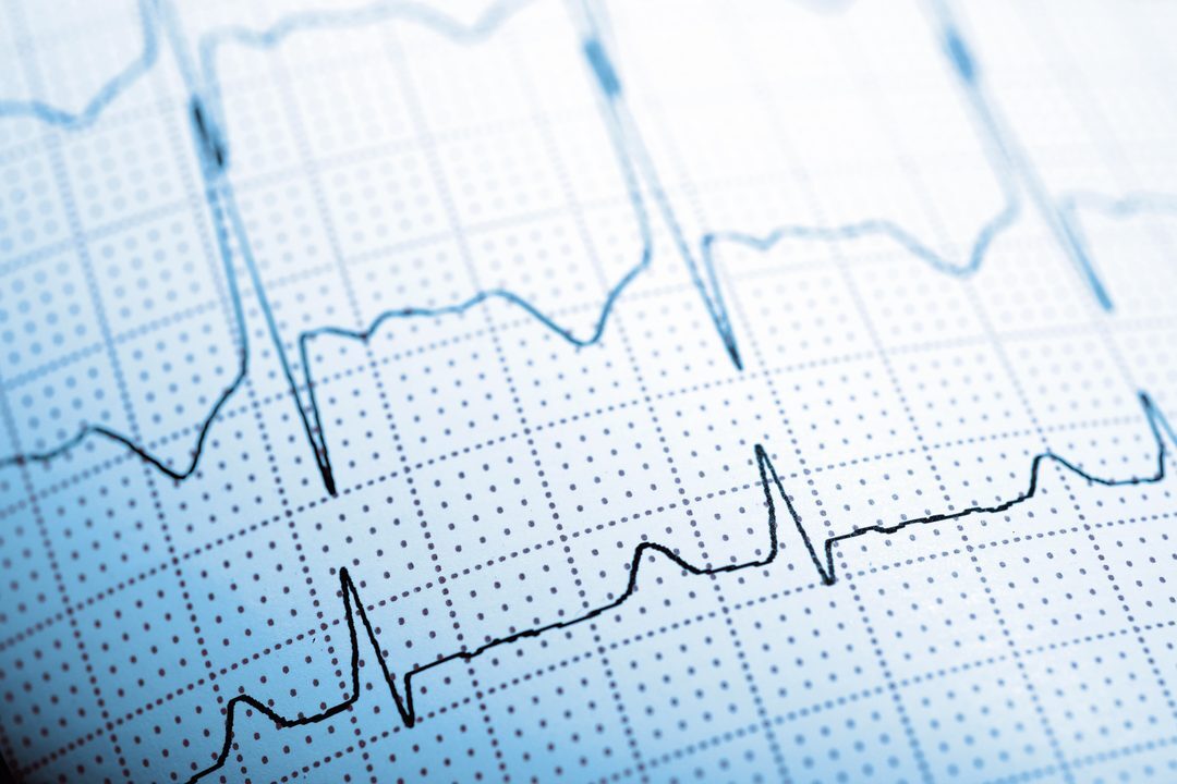 ecg paper
